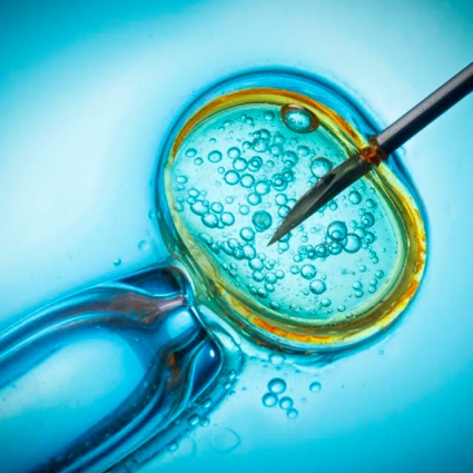 Stunning treatment of infertility with Platelet enriched (Lympho-PRP in IVF)